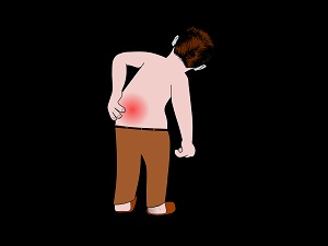 What It Means To Throw Your Back Out