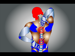 Some Stretches For Relieving Back Pain